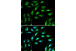 Immunofluorescence analysis of MCF-7 cells using B2M antibody (ABIN5970743). (beta-2 Microglobulin Antikörper)