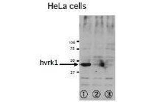 Western Blotting (WB) image for anti-Vaccinia Related Kinase 1 (VRK1) (N-Term) antibody (ABIN2452161)