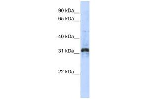 WB Suggested Anti-ZNF705D Antibody Titration:  0. (ZNF705D Antikörper  (Middle Region))