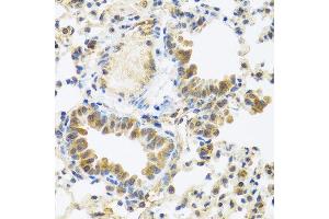 Immunohistochemistry of paraffin-embedded mouse lung using C8orf4 antibody at dilution of 1:100 (40x lens). (C8orf4 Antikörper)