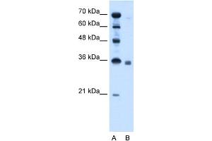 WB Suggested Anti-SGPP2 Antibody Titration:  2. (SGPP2 Antikörper  (C-Term))