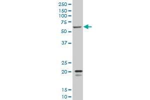SMARCD3 monoclonal antibody (M02), clone 5F12 Western Blot analysis of SMARCD3 expression in K-562 . (SMARCD3 Antikörper  (AA 385-483))