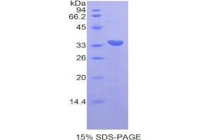 SDS-PAGE analysis of Mouse CDK7 Protein. (CDK7 Protein)