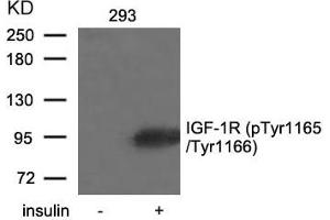 Western blot analysis of extracts from 293 cells untreated or treated with insulin using IGF-1R(Phospho-Tyr1165/Tyr1166) Antibody. (IGF1R Antikörper  (pTyr1165, pTyr1166))