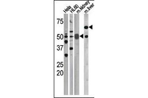 The anti-Phospho-CDC25A-S75 Pab (ABIN389531 and ABIN2839579) is used in Western blot to detect Phospho-CDC25A-S75 in, form left to right, Hela, HL60, mouse kidney, and mouse liver tissue lysates. (CDC25A Antikörper  (pSer75))