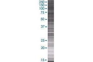 MMD2 transfected lysate. (MMD2 293T Cell Transient Overexpression Lysate(Denatured))