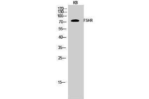 Western Blotting (WB) image for anti-Follicle Stimulating Hormone Receptor (FSHR) (Internal Region) antibody (ABIN3175168) (FSHR Antikörper  (Internal Region))