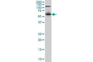 IRF5 monoclonal antibody (M04), clone 3C2 Western Blot analysis of IRF5 expression in A-431 . (IRF5 Antikörper  (AA 395-504))