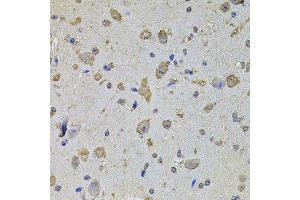 Immunohistochemistry of paraffin-embedded mouse brain using EIF4A2 antibody (ABIN5972034) at dilution of 1/100 (40x lens). (EIF4A2 Antikörper)