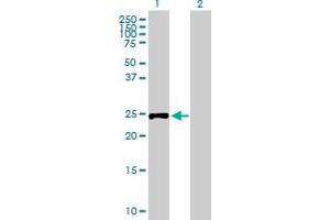 Western Blot analysis of RPIA expression in transfected 293T cell line by RPIA MaxPab polyclonal antibody. (Ribose 5-Phosphate Isomerase A (RPIA) (AA 1-237) Antikörper)