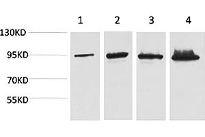 Western blot analysis of 1) Hela, 2) 293T, 3) Mouse Liver tissue, 4) Rat Liver tissue using Catenin-β Monoclonal Antibody. (beta Catenin Antikörper)