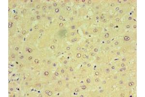 Immunohistochemistry of paraffin-embedded human liver tissue using ABIN7159923 at dilution of 1:100 (CHCHD4 Antikörper  (AA 1-142))