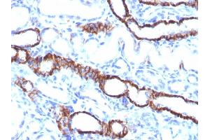 Immunohistochemistry (IHC) image for anti-Cadherin-16 (CDH16) antibody (ABIN6939024)