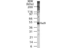 Image no. 1 for anti-RAD9 Homolog A (S. Pombe) (RAD9A) antibody (ABIN208030) (RAD9A Antikörper)