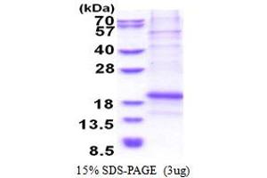 SDS-PAGE (SDS) image for Leukocyte Cell Derived Chemotaxin 1 (LECT1) (AA 214-333) protein (His tag) (ABIN5853515) (LECT1 Protein (AA 214-333) (His tag))