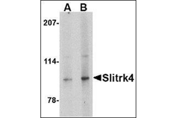 SLITRK4 Antikörper  (C-Term)