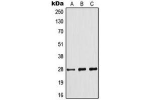 Western blot analysis of BCL2 (pS70) expression in Jurkat (A), THP1 (B), A2780 (C) whole cell lysates. (Bcl-2 Antikörper  (pSer70))