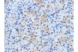 Immunohistochemistry of paraffin-embedded rat ovary using PP1 beta Rabbit mAb (ABIN1679819, ABIN3018859, ABIN3018860 and ABIN7101675) at dilution of 1:100 (40x lens). (PPP1CB Antikörper)