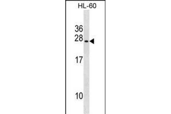 UBE2S Antikörper  (C-Term)