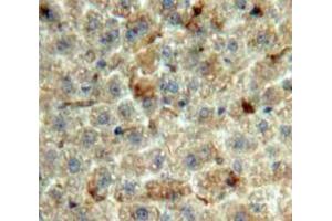 Used in DAB staining on fromalin fixed paraffin-embedded Liver tissue (GDF2 Antikörper  (AA 22-178))