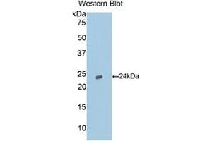 Western blot analysis of the recombinant protein. (Caspase 9 Antikörper  (AA 1-200))