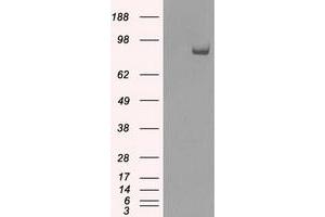 Western Blotting (WB) image for anti-SATB Homeobox 1 (SATB1) antibody (ABIN1500812) (SATB1 Antikörper)