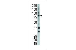 Antibody is used in Western blot to detect BMX in mouse heart tissue lysate. (BMX Antikörper  (AA 212-242))
