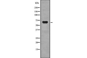 Western blot analysis of CD42b using MCF7 whole cell lysates (CD42b Antikörper  (C-Term))