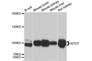 Western blot analysis of extracts of various cell lines, using XPOT antibody (ABIN5999202) at 1:3000 dilution. (XPOT Antikörper)