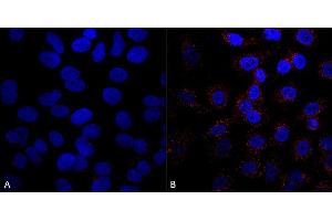Immunocytochemistry/Immunofluorescence analysis using Mouse Anti-VPS35 Monoclonal Antibody, Clone 5A9 (ABIN6932953). (VPS35 Antikörper  (PerCP))