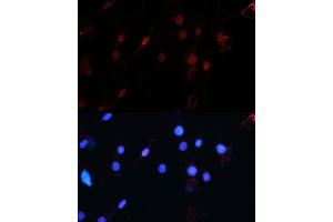 Immunofluorescence analysis of C6 using ZEB1 antibody (ABIN6129933, ABIN6150422, ABIN6150423 and ABIN6221237) at dilution of 1:100 (40x lens). (ZEB1 Antikörper  (AA 1-260))
