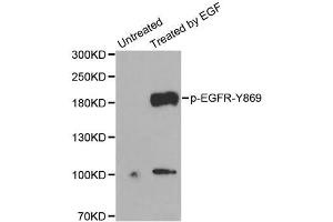 Western Blotting (WB) image for anti-Epidermal Growth Factor Receptor (EGFR) (pTyr869) antibody (ABIN1870109) (EGFR Antikörper  (pTyr869))