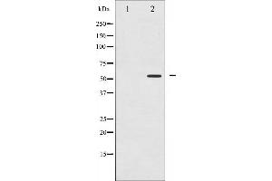 Western blot analysis of PPAR- gamma phosphorylation expression in Paclitaxel treated Jurkat whole cell lysates,The lane on the left is treated with the antigen-specific peptide. (PPARG Antikörper  (pSer112))