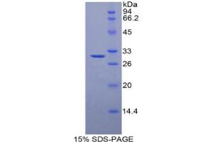 SDS-PAGE analysis of Pig alpha 2-Macroglobulin Protein. (alpha 2 Macroglobulin Protein)