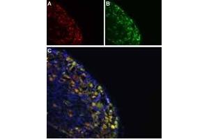 Colocalization of NaV1. (Synaptophysin Antikörper  (Intravesicular Loop))