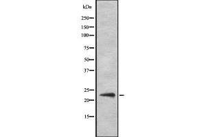Western blot analysis of SOCS2 Antibody expression in Hela cells lysates. (SOCS2 Antikörper)