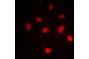 Immunofluorescent analysis of Histone H4 (AcK5) staining in HeLa cells. (Histone H4 Antikörper  (acLys5, N-Term))