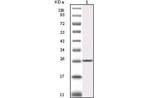 Western blot analysis using IKBKB mouse mAb against truncated IKBKB recombinant protein (1). (IKBKB Antikörper)