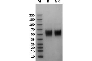 Human Fc gamma RIIIa / CD16a (176F) protein on Coomassie Blue stained SDS-PAGE under non-reducing (NR) and reducing (R) conditions. (FCGR3A Protein (AA 17-208) (His-Avi Tag))