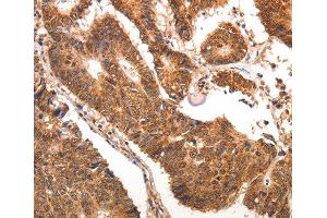 Immunohistochemistry (IHC) image for anti-Chemokine (C-C Motif) Ligand 17 (CCL17) antibody (ABIN1871510) (CCL17 Antikörper)