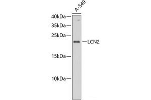 Western blot analysis of extracts of A-549 cells using LCN2 Polyclonal Antibody at dilution of 1:1000. (Lipocalin 2 Antikörper)