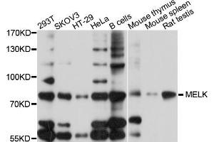 Western blot analysis of extracts of various cell lines, using MELK antibody (ABIN5998212) at 1/1000 dilution. (MELK Antikörper)