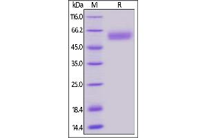 Biotinylated Human BTLA (31-150), Fc,Avitag on  under reducing (R) condition. (BTLA Protein (AA 31-150) (Fc Tag,AVI tag,Biotin))