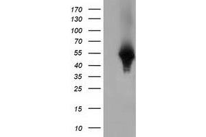 HEK293T cells were transfected with the pCMV6-ENTRY control (Left lane) or pCMV6-ENTRY HP (Right lane) cDNA for 48 hrs and lysed. (Haptoglobin Antikörper)