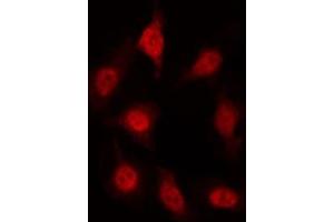 ABIN6267419 staining HT29 by IF/ICC. (AFT1 Antikörper  (pSer63))