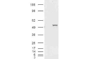 HEK293 overexpressing ALDH1A1 and probed with ABIN2561029 (mock transfection in first lane). (ALDH1A1 Antikörper  (Internal Region))