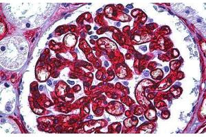 Human Kidney, Glomerulus: Formalin-Fixed, Paraffin-Embedded (FFPE) (CD34 Antikörper)