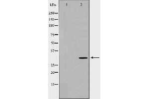 Western blot analysis of extracts of jurkat using CASP3 antibody. (Caspase 3 Antikörper  (N-Term))