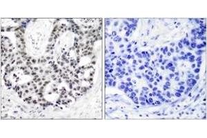 Immunohistochemistry (IHC) image for anti-Androgen Receptor (AR) (pSer650) antibody (ABIN2888357) (Androgen Receptor Antikörper  (pSer650))