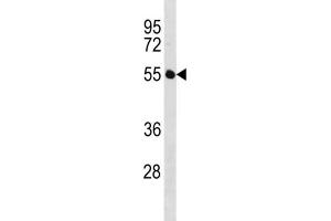 Western Blotting (WB) image for anti-Immunoglobin Superfamily, Member 21 (IGSF21) antibody (ABIN3004517) (IGSF21 Antikörper)